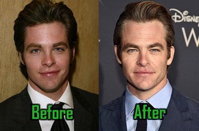 A picture of Chris Pine before (left) and after (right).